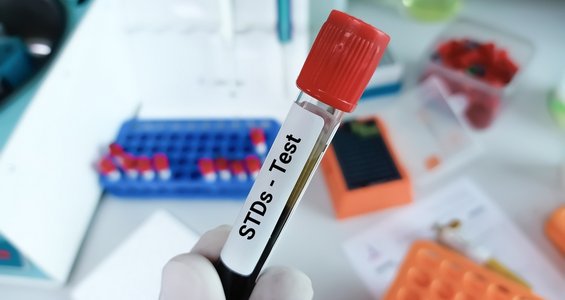 STDs and Infections