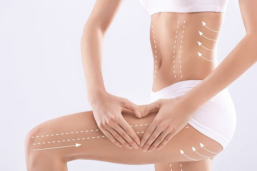 Body Contouring Services